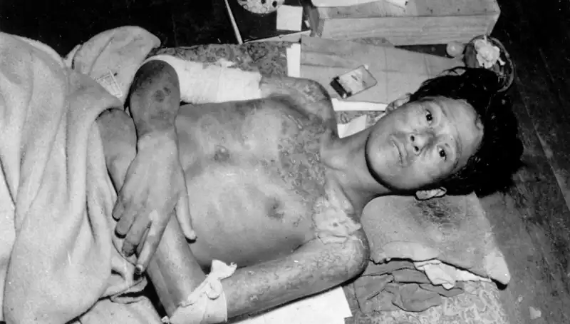 80 Yıl Sonra Nagasaki’den Korkutucu Uyarı: Nükleer Felaket yaklaşmakta